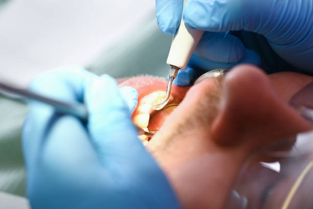 Best Broken or Chipped Tooth Repair in Vidalia, LA