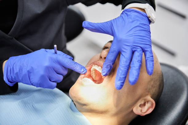 Best Lost Filling or Crown Replacement in Vidalia, LA