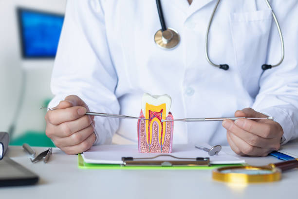 Best Knocked-Out Tooth (Avulsed Tooth) Treatment in Vidalia, LA
