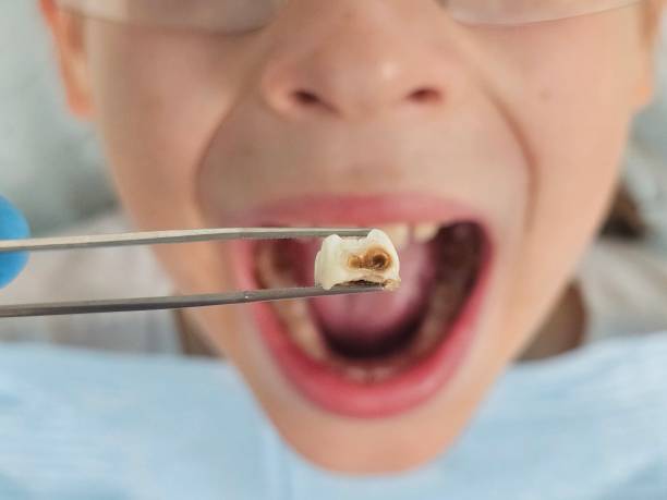 Best Emergency Treatment for Jaw Pain or Injury in Vidalia, LA