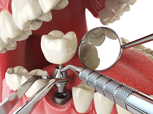 Best Emergency Cosmetic Dentistry (e.g., broken veneers) in Vidalia, LA